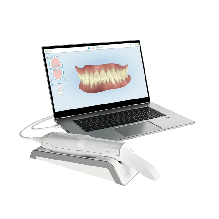 Zimmer iTero Element Flex Intraoral Scanner