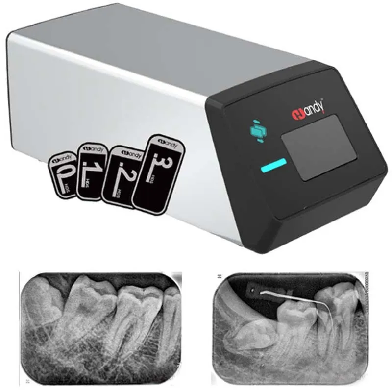 Handy HDS-500 Digital Imaging Plate PSP Scanner