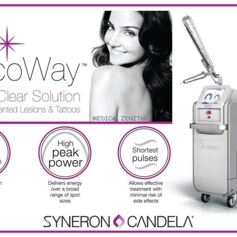 CANDELA PICOWAY PICOSECOND LASER