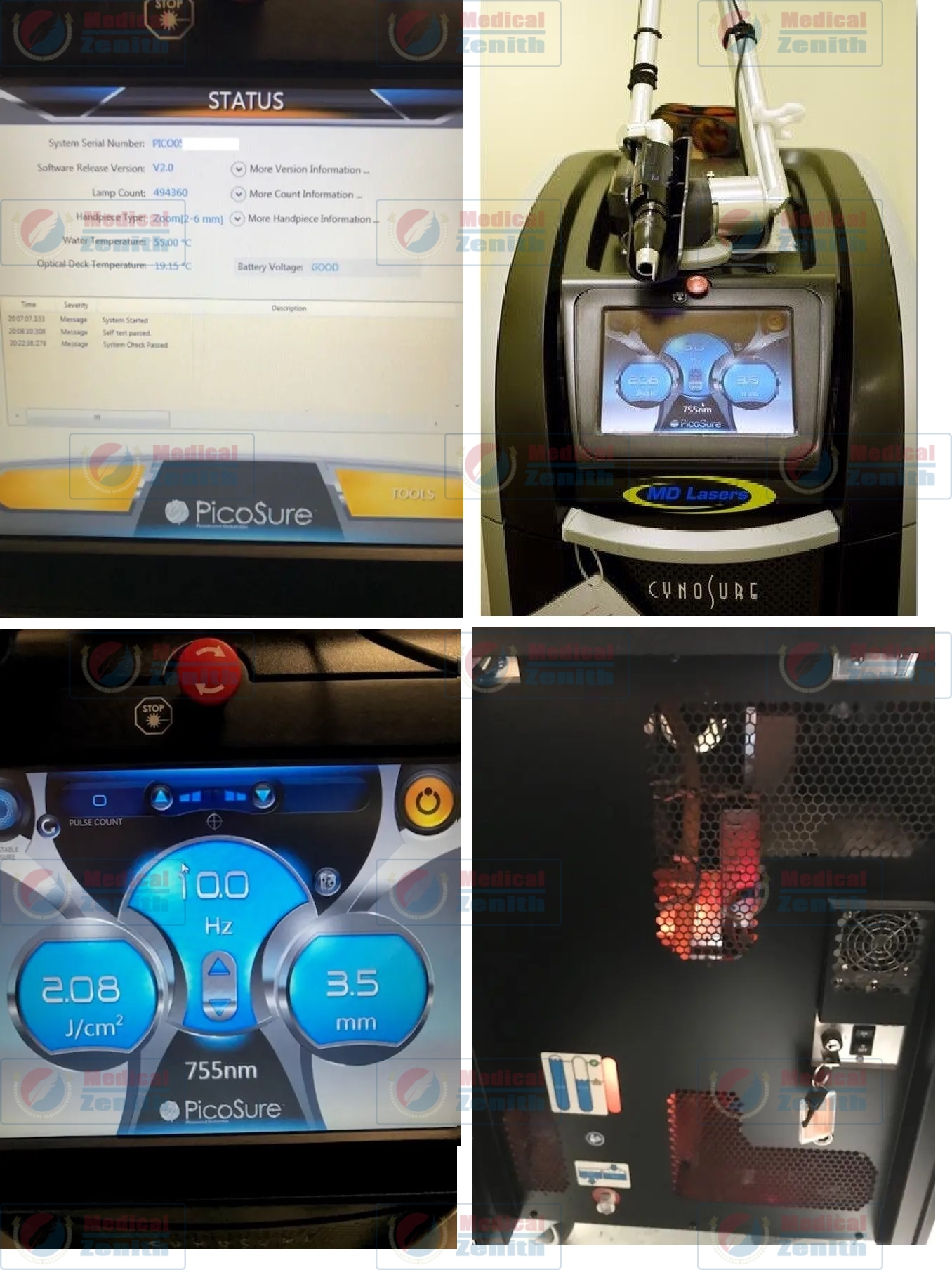 cynosure picosure laser