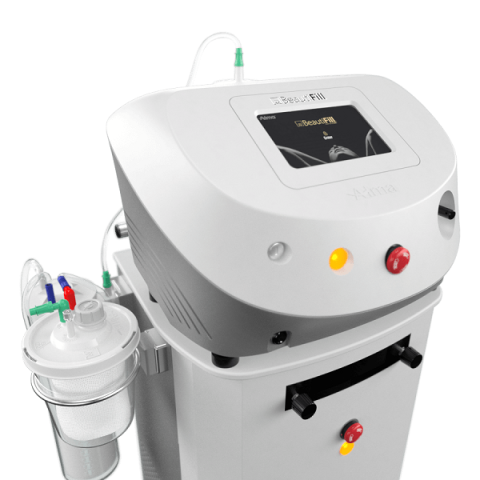 alma beautifill liposuction