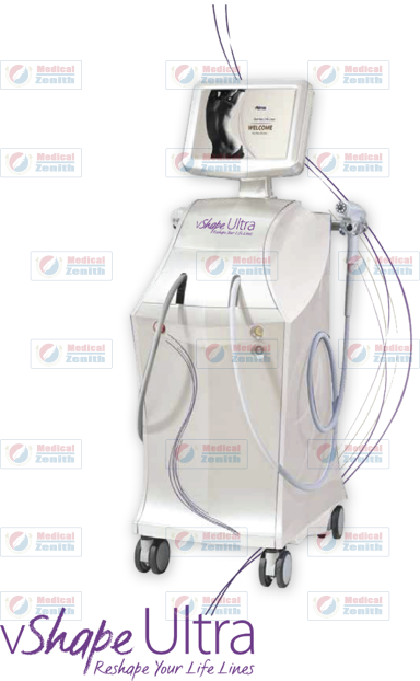alma vshape